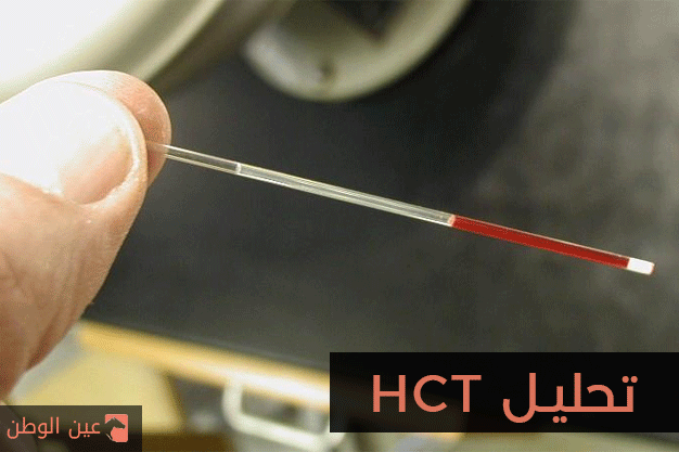 تحليل HCT وماهو hct في تحليل الدم ومتى يكون طبيعي ومتى يكون منخفض